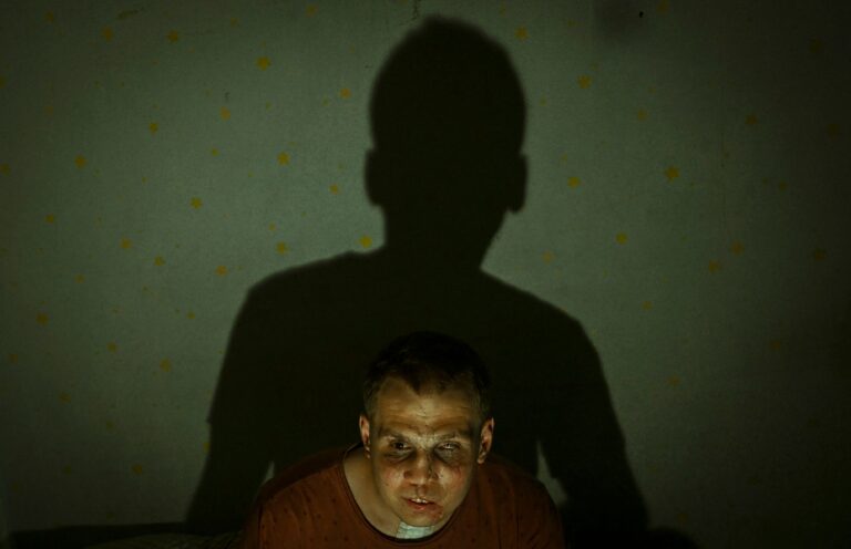 The bitter face of war, photographed by Ercin Erturk. One Frame honourable mention, Shoot The Frame 2025.