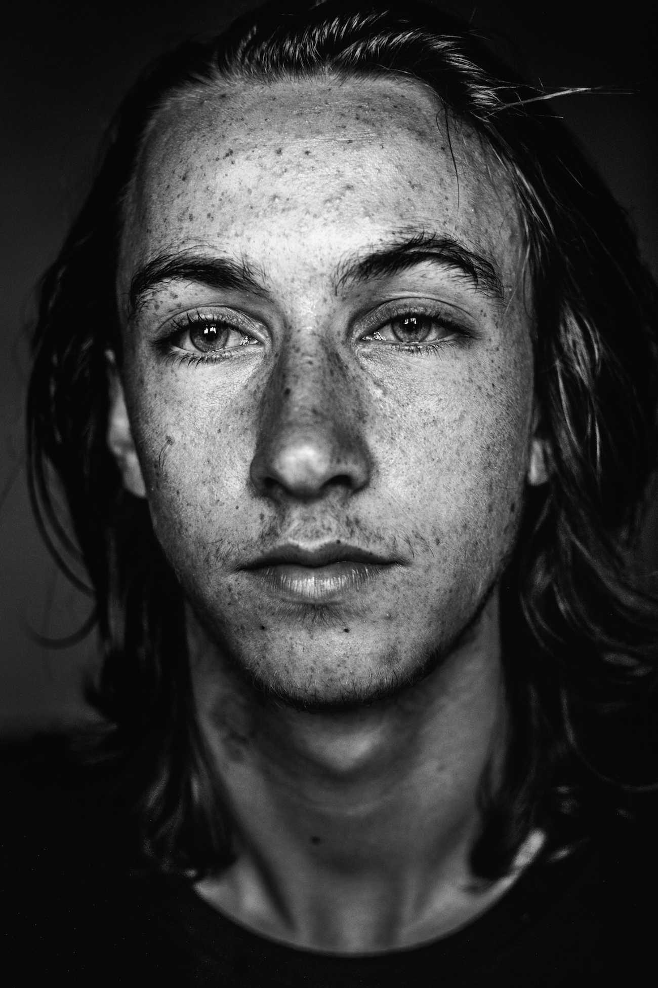 Man preckle, marks. Portrait photograph by Hugo Hentoff, finalist in the Shoot The Frame Portrait photography award, June 2015