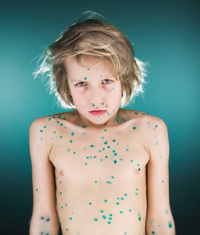 Child, greendot. Portrait photograph by Al Lapkovsky, finalist in the Shoot The Frame Portrait photography award, August 2017