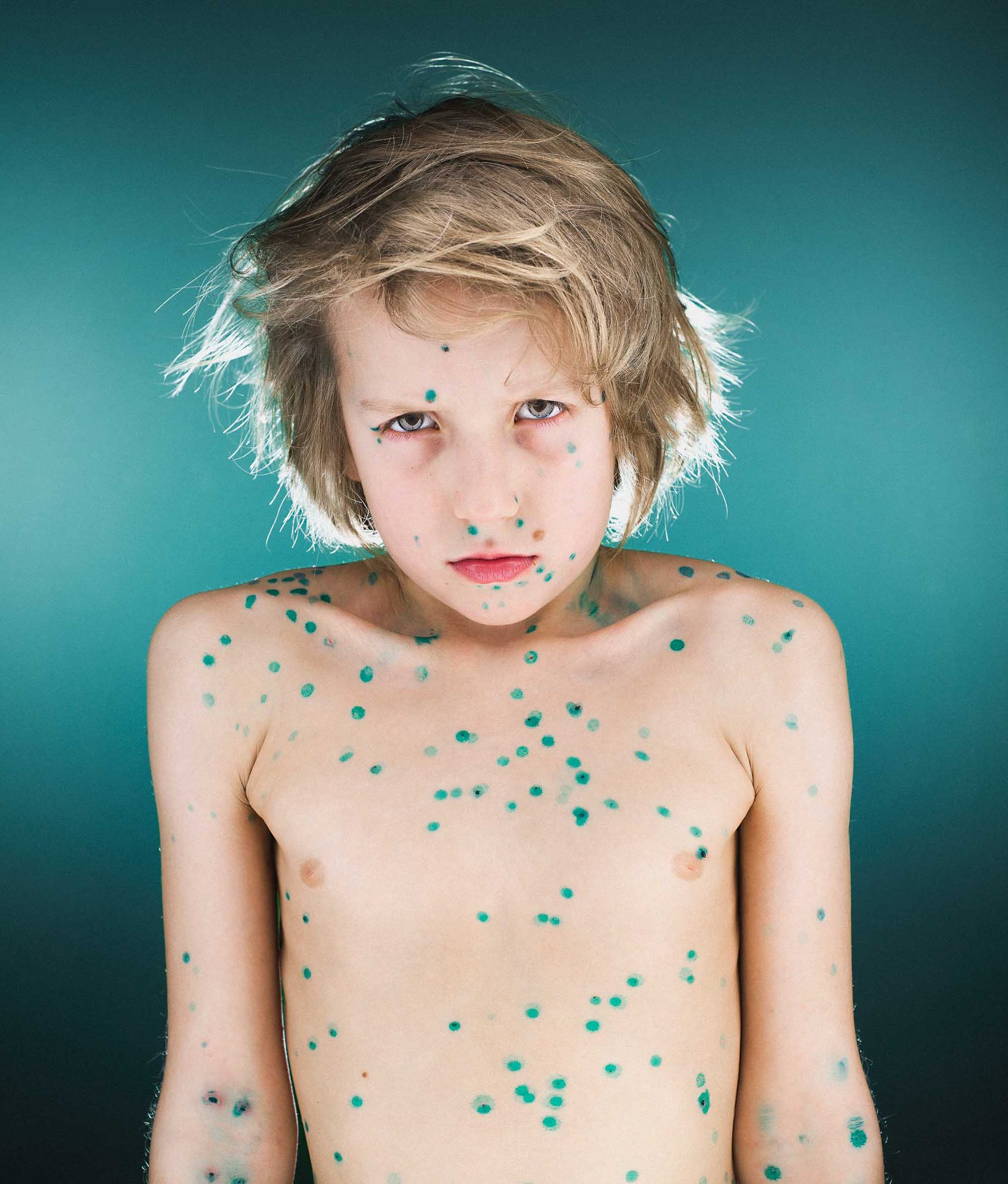 Child, greendot. Portrait photograph by Al Lapkovsky, finalist in the Shoot The Frame Portrait photography award, August 2017